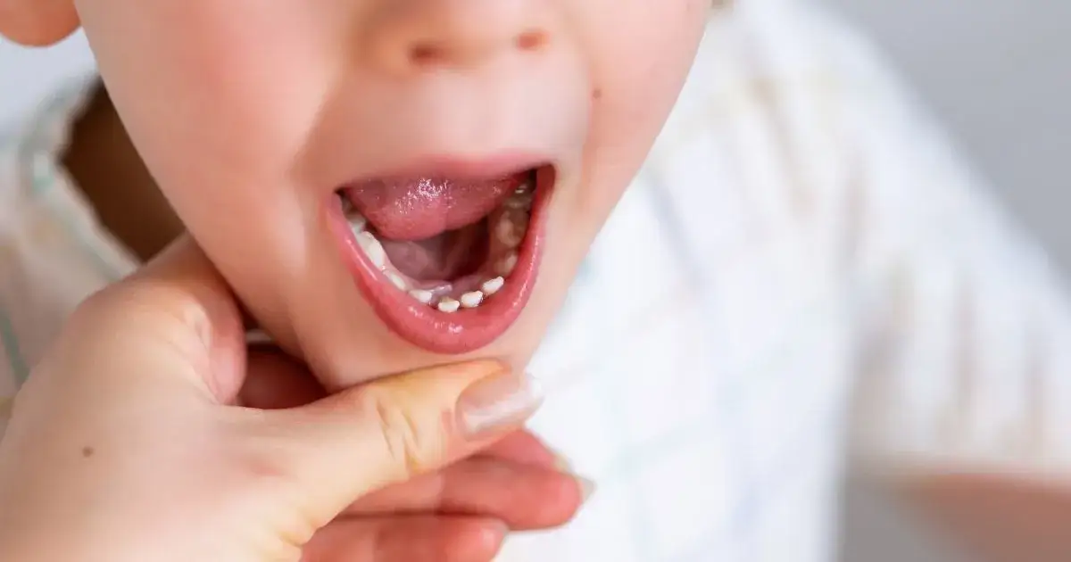 Zdjęcie Dlaczego dziecko zgrzyta zębami w nocy? Poznaj przyczyny i skutki