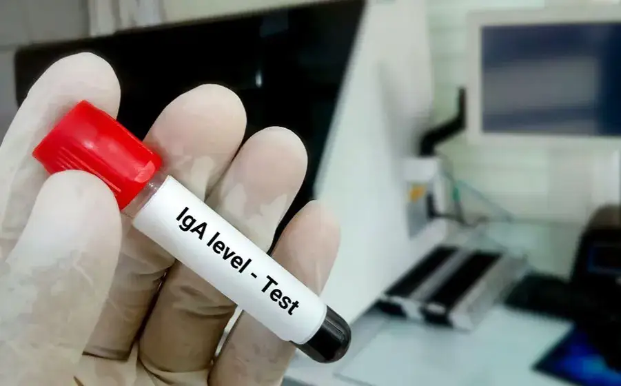 Zdjęcie Badanie IgA - co to jest i jak może wpłynąć na Twoje zdrowie?