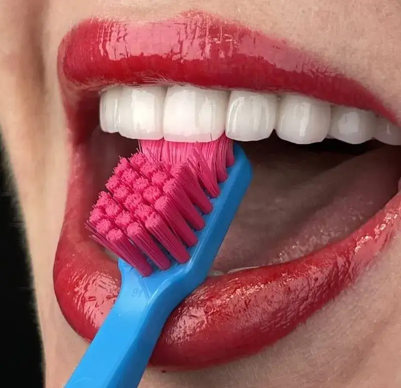 Zdjęcie Jak czyścić mosty zębowe: skuteczne metody i narzędzia higieny