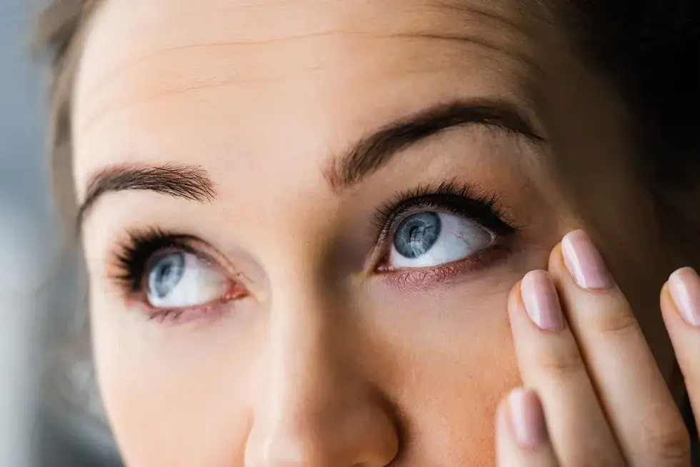 Zdjęcie Jak wyjąć rzęsę z oka: bezpieczne metody na szybkie usunięcie