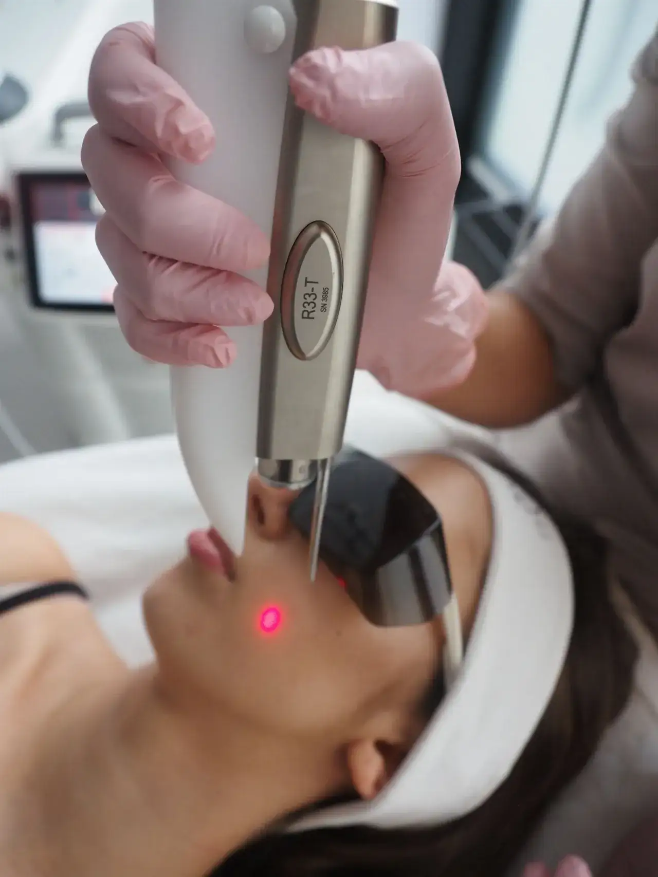 Zdjęcie Laser frakcyjny na co pomaga - skuteczne rozwiązania dla Twojej skóry