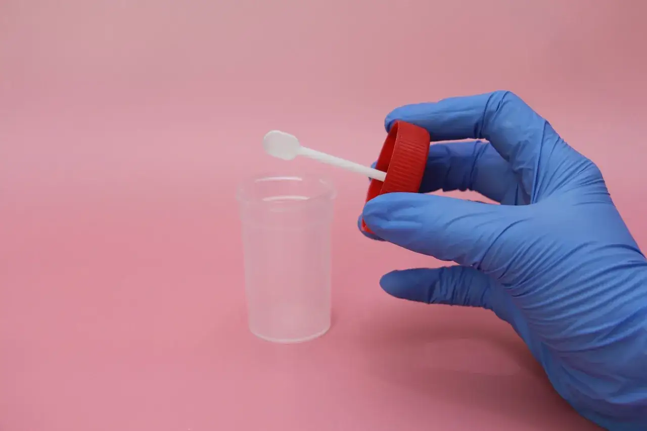 Zdjęcie Ile kosztuje badanie kału na pasożyty? Ceny w różnych laboratoriach