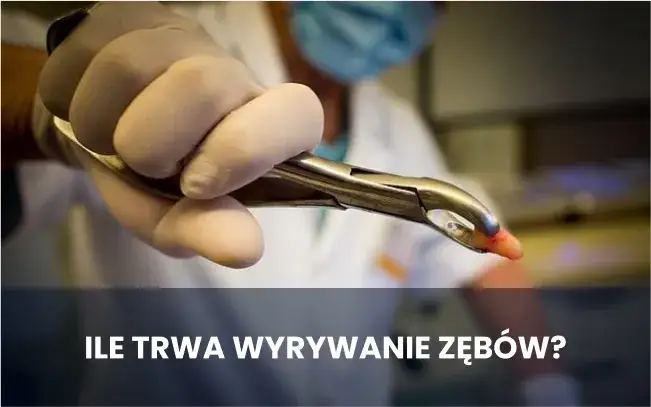 Zdjęcie Ile trwa wizyta u dentysty? Poznaj czas trwania różnych zabiegów