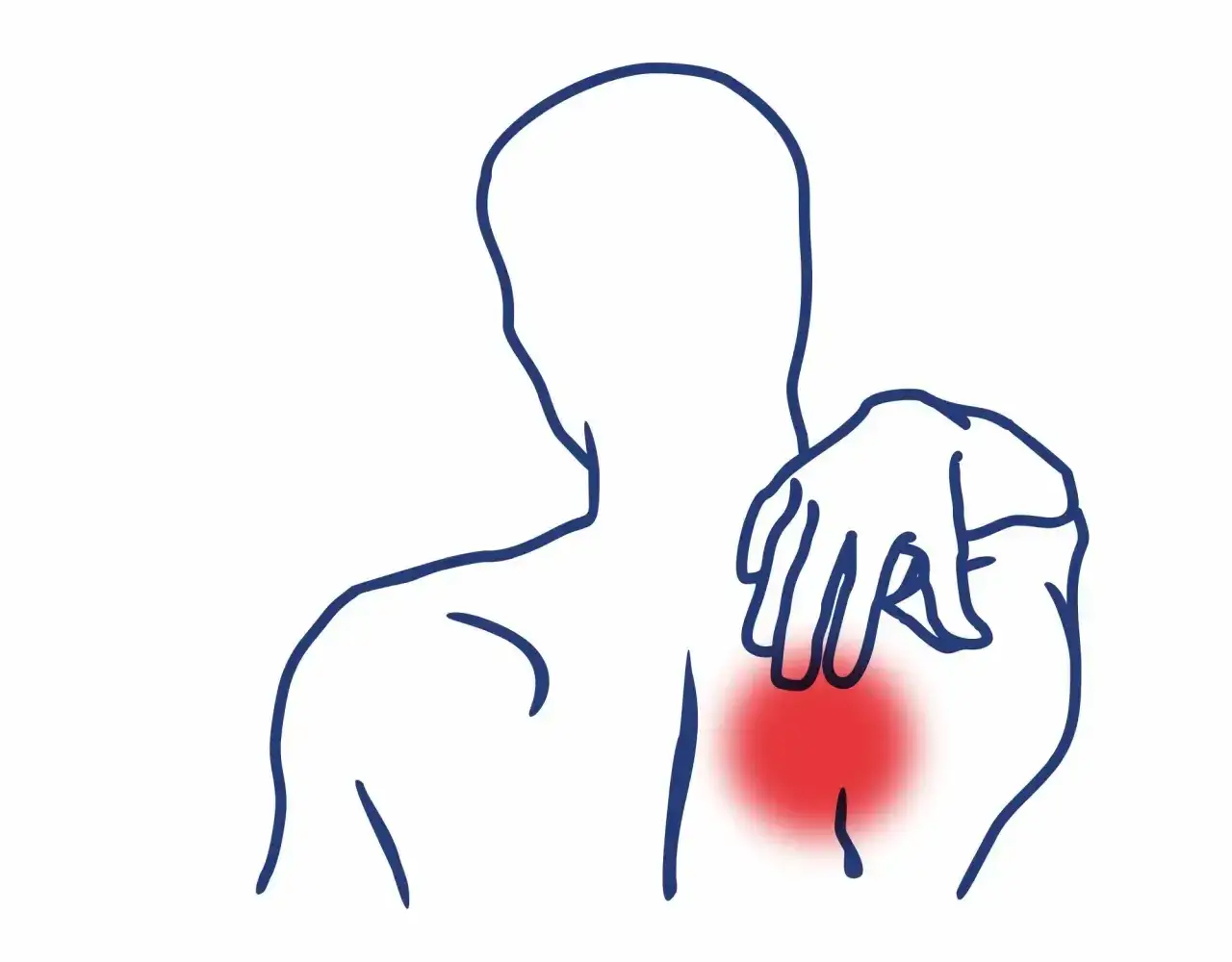 Zdjęcie Napięty mięsień czworoboczny objawy – jak uniknąć bólu i dyskomfortu