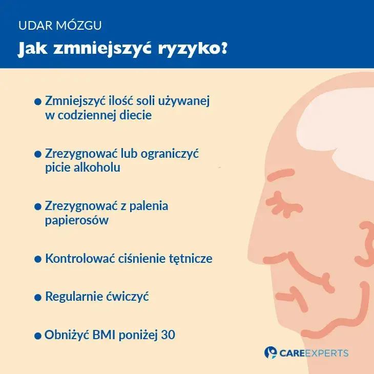 Zdjęcie Mini udar: objawy, leczenie i profilaktyka - co musisz wiedzieć