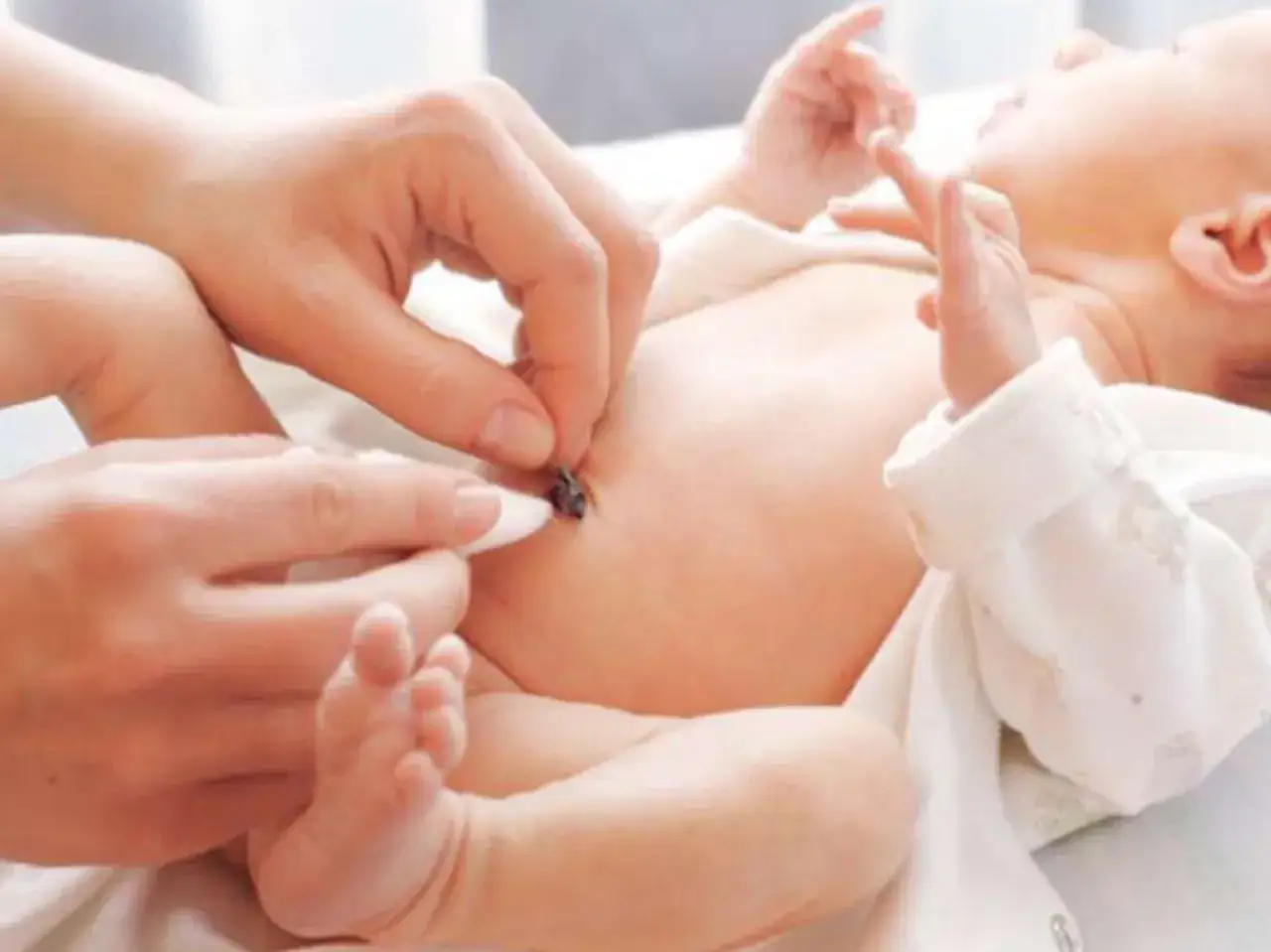 Zdjęcie Jak czyścić pępek niemowlaka - proste sposoby na zdrową pielęgnację