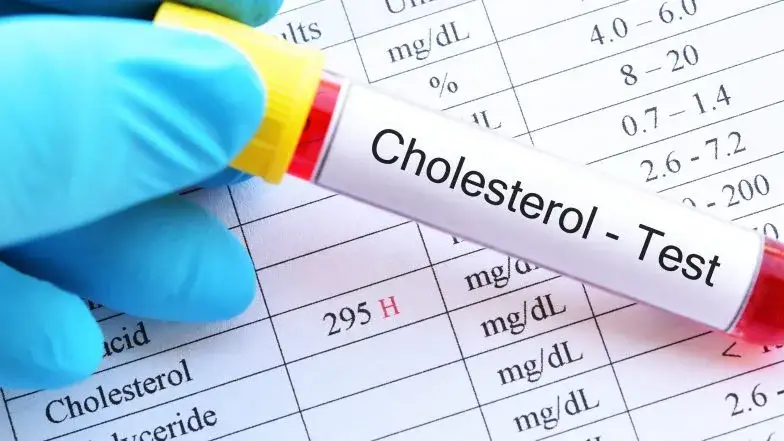 Zdjęcie Jaki lekarz leczy cholesterol? Sprawdź, kto pomoże obniżyć jego poziom