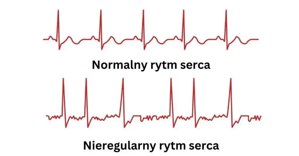 Zdjęcie Co oznacza symbol serca na ciśnieniomierzu: czy powinieneś się niepokoić?