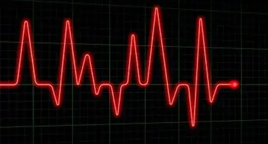 Zdjęcie Prawidłowy puls podczas snu: Co mówią normy i objawy?