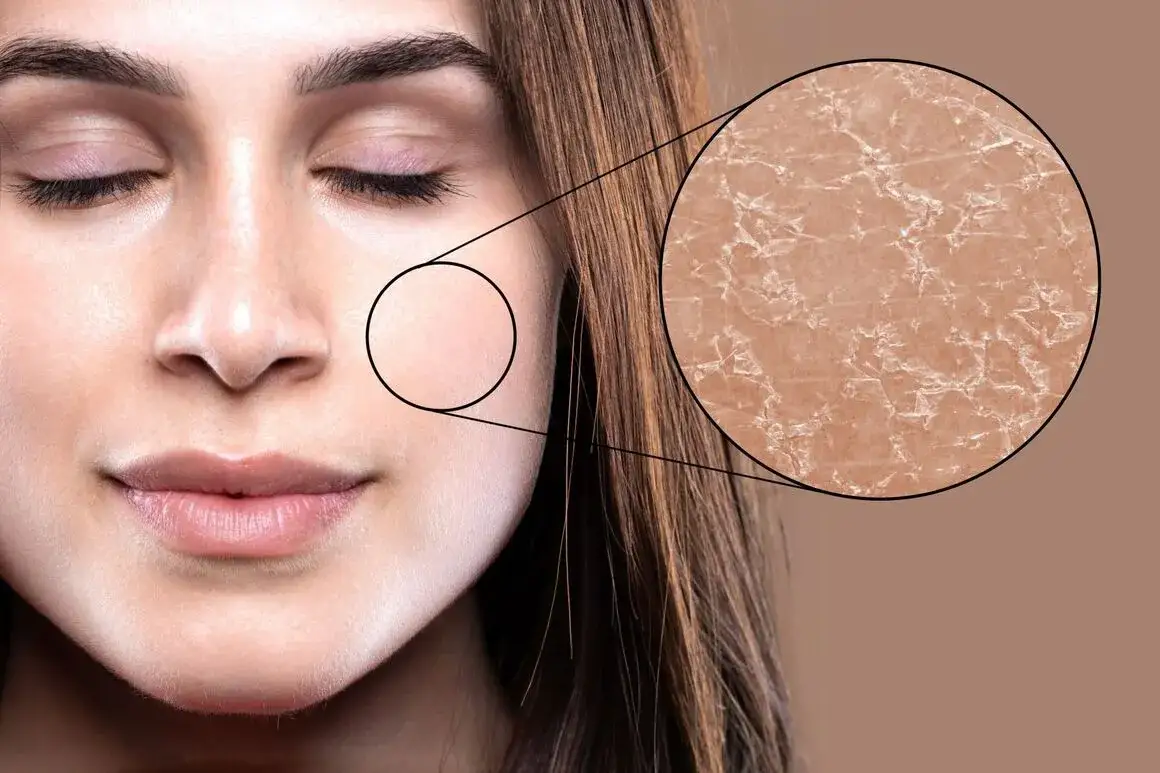 Zdjęcie Ursachen und Lösungen für trockene schuppige Gesichtshaut verstehen