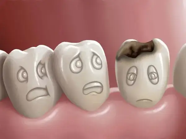 Zdjęcie Jak wyleczyć próchnicę bez dentysty i uniknąć bólu zębów
