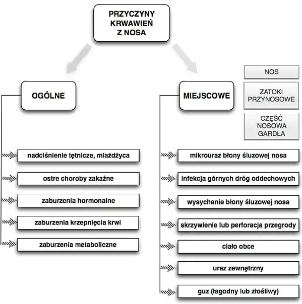 Zdjęcie Przyczyna krwawienia z nosa – poznaj najczęstsze powody i objawy