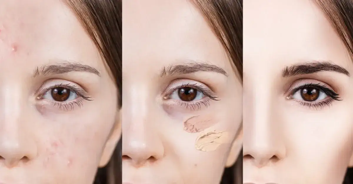Zdjęcie Makijaż zakrywający niedoskonałości – efektywne techniki i produkty