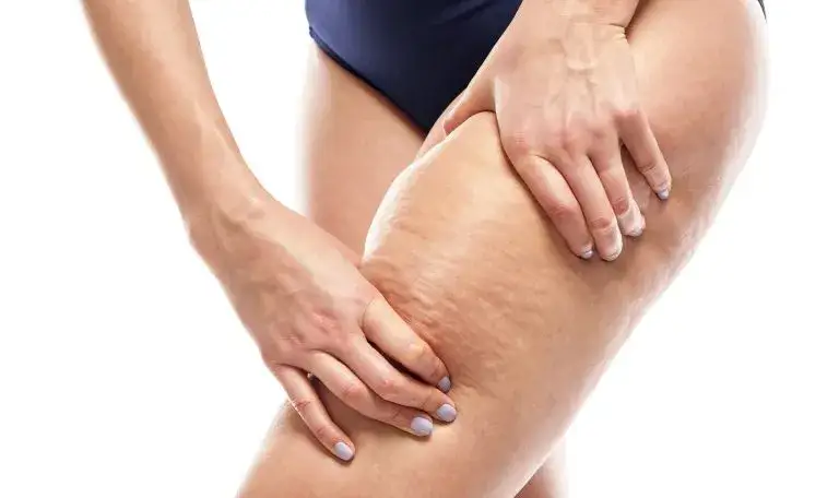 Zdjęcie Dlaczego mężczyźni nie mają cellulitu? Oto zaskakujące przyczyny