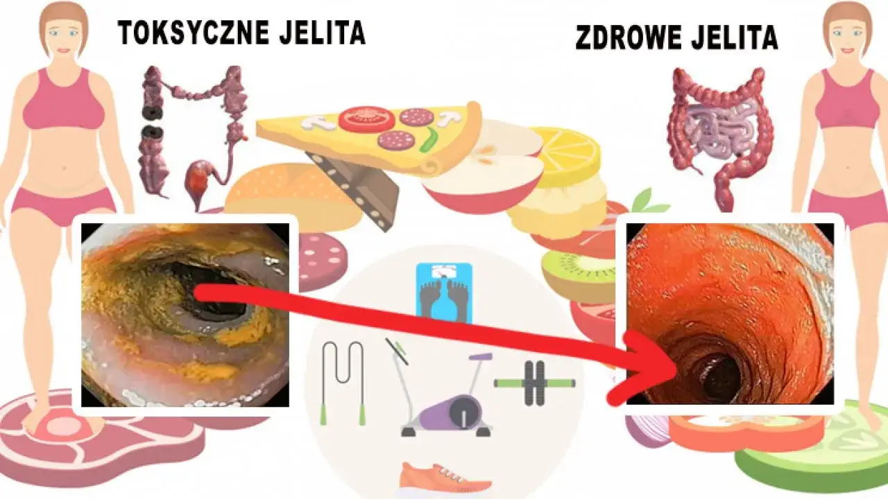 Zdjęcie Jak odbudować jelita? 7 skutecznych sposobów na zdrowy mikrobiom