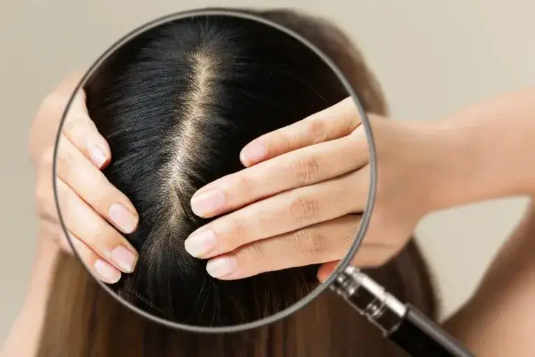 Zdjęcie Co na włosy i paznokcie: skuteczne suplementy i naturalne metody