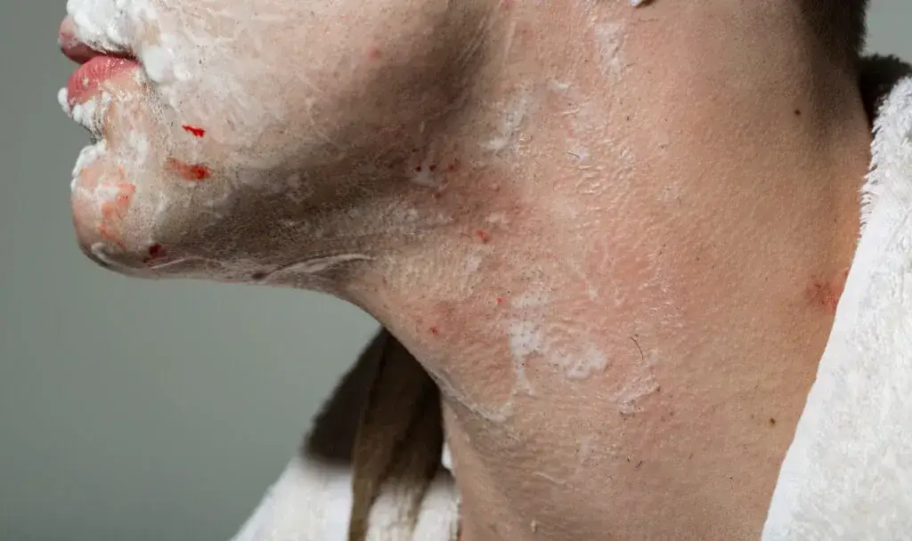 Zdjęcie Jak prawidłowo się golić, aby uniknąć podrażnień i zacięć