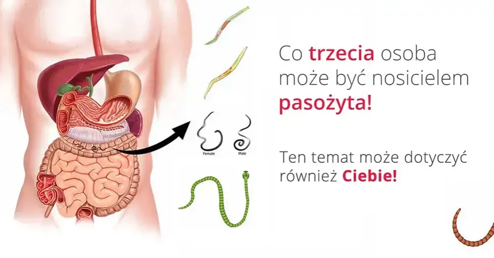Zdjęcie Pasożyty objawy – rozpoznaj groźne symptomy i uniknij problemów zdrowotnych