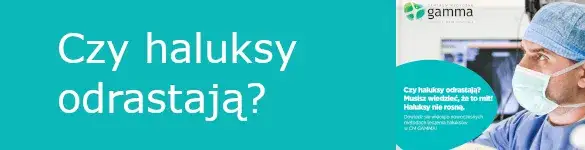Zdjęcie Czy haluksy odrastają? Poznaj ryzyko nawrotu i jak go uniknąć