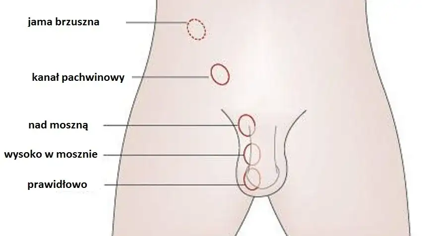 Zdjęcie Jak prawidłowo wykonać badanie jąder u mężczyzn: krok po kroku