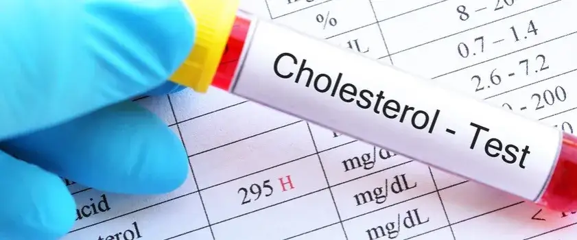 Zdjęcie Jakie badanie na cholesterol pomoże ocenić Twoje zdrowie?