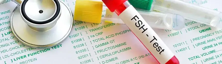 Zdjęcie Badanie FSH u mężczyzn: co oznacza i dlaczego jest tak ważne w diagnozie