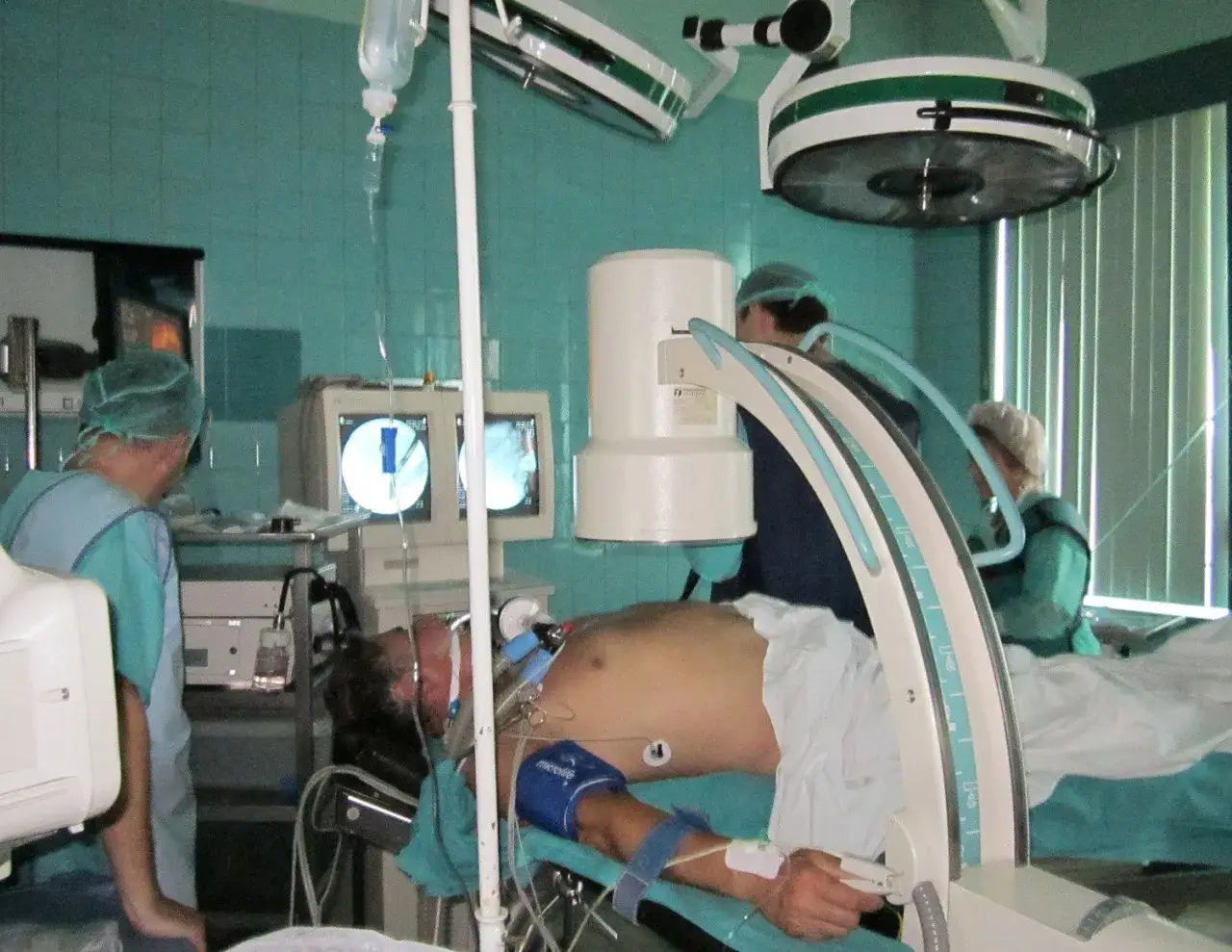 Zdjęcie Badanie ERCP na czym polega: wszystko, co musisz wiedzieć o procedurze
