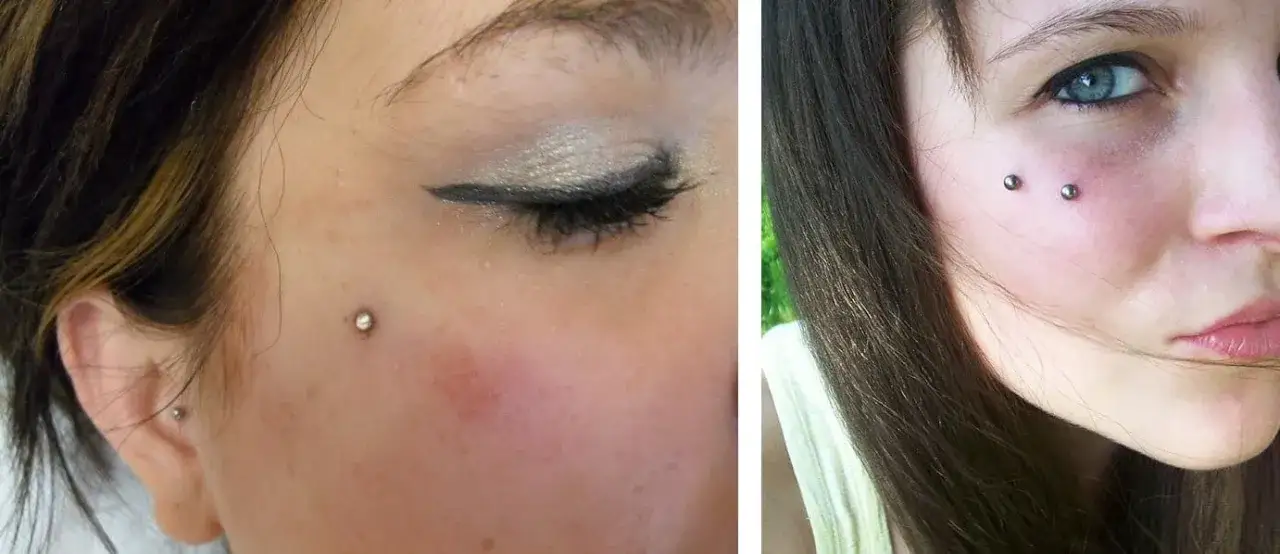 Jak bezpiecznie wykonać microdermal kolczyk - krok po kroku