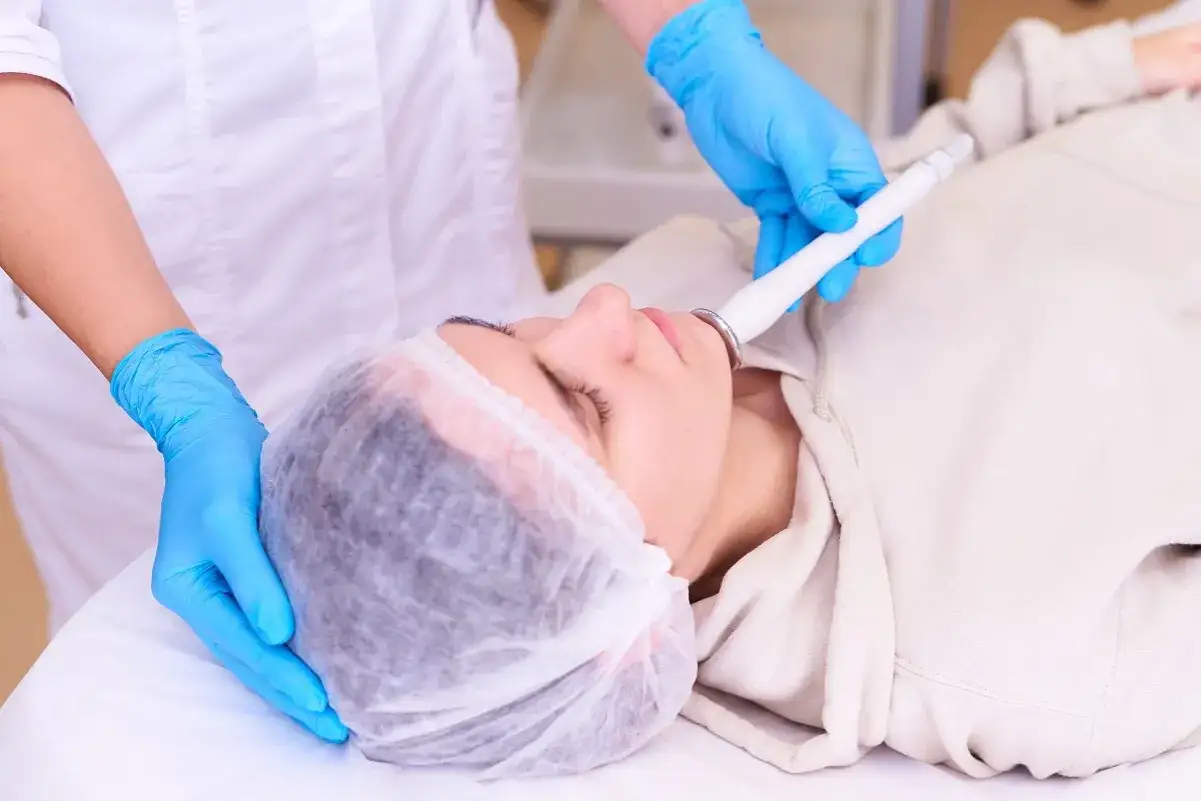 RF mikroigłowa: Skutki uboczne i powikłania co musisz wiedzieć?