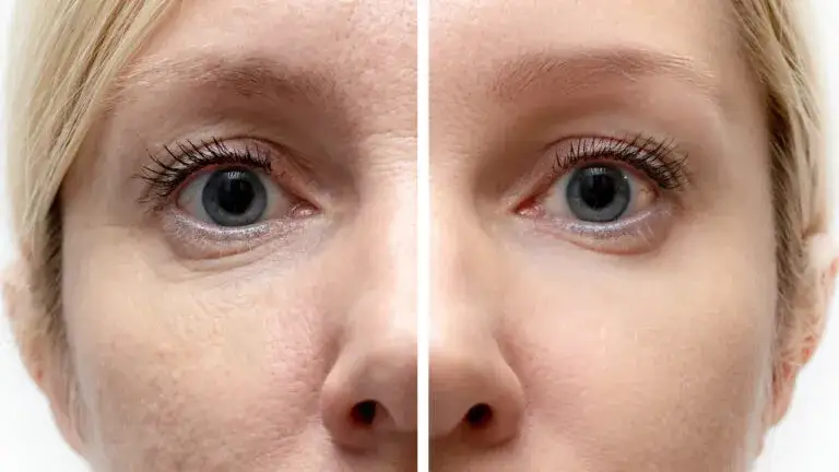 Wodorowe oczyszczanie twarzy: poznaj opinie i efekty zabiegu