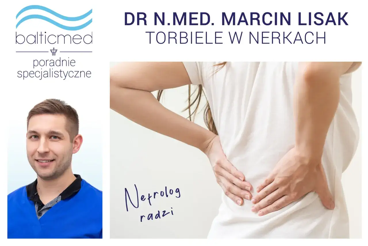 Dr. Marcin Lisak radzi o torbielach w nerkach. Nefrolog wyjaśnia, jak leczyć torbiele nerek.