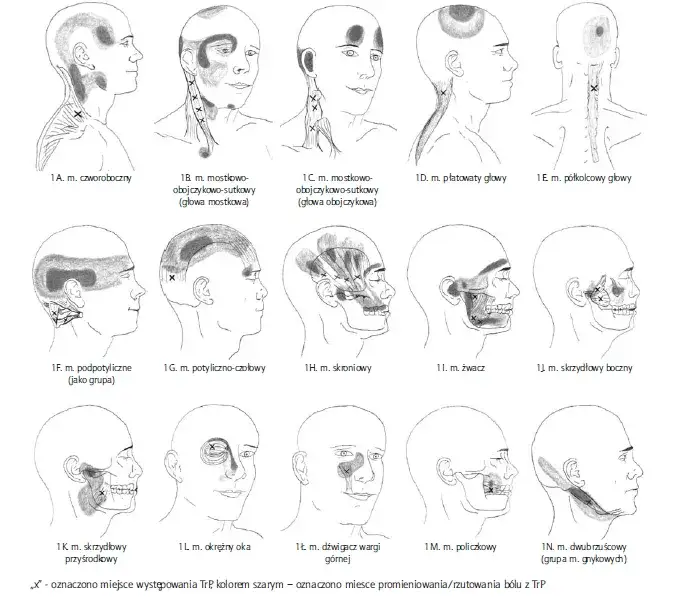 Skuteczne metody leczenia napięciowego bólu głowy i ulga w bólu