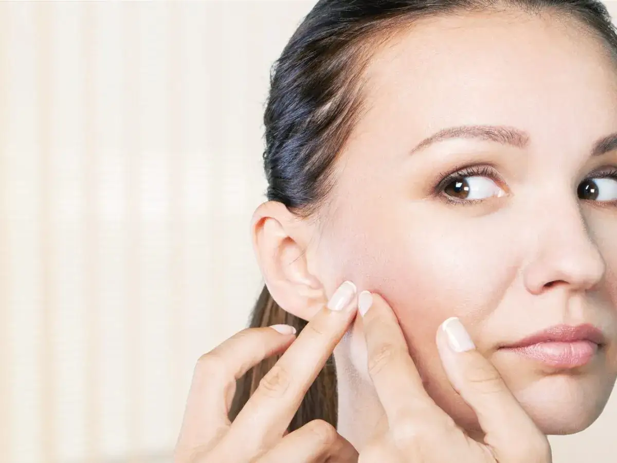 Czym posmarować pryszcza? Skuteczne metody i błędy do uniknięcia.