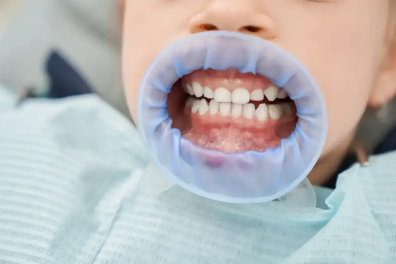 Uśmiechnięte siekacze u dziecka, gotowe na wizytę u dentysty.