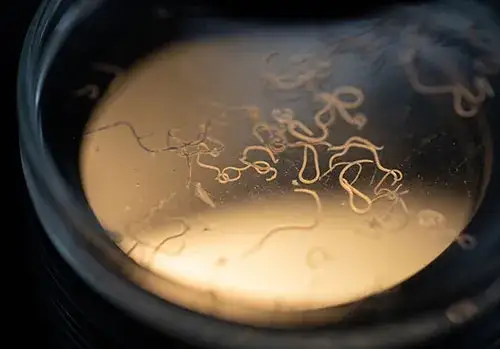 Czego nie jeść przy odrobaczaniu, aby skutecznie pozbyć się pasożytów