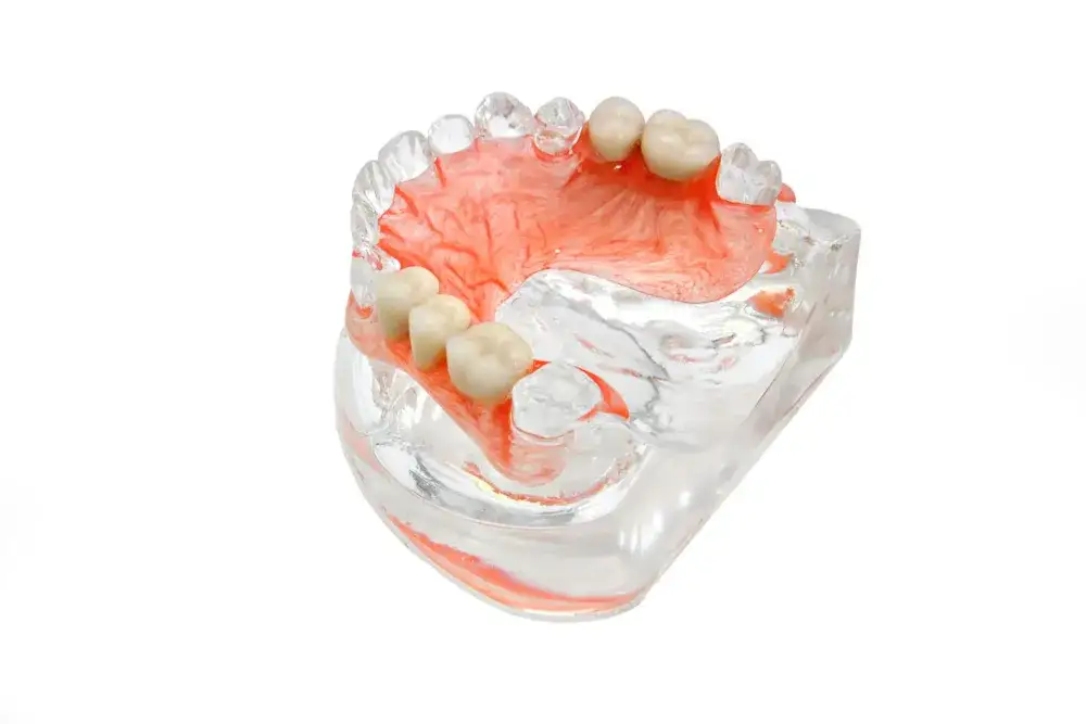 Skuteczne metody czyszczenia protez z acronu, które musisz znać