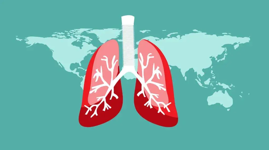 Czy gruźlica jest chorobą zakaźną? Poznaj fakty o przenoszeniu infekcji