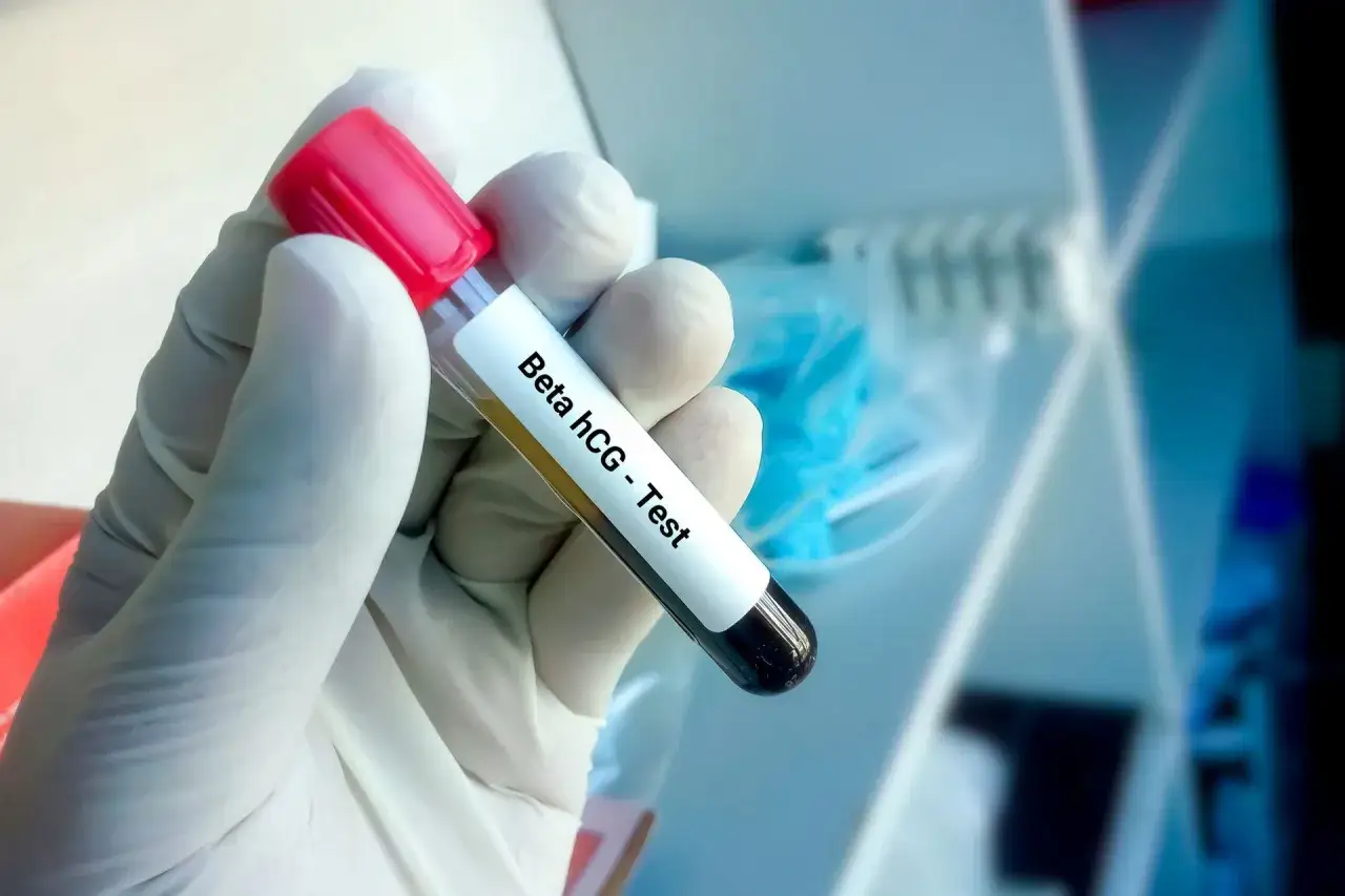 Podwyższone hCG: ciąża czy coś więcej? Pełna interpretacja.