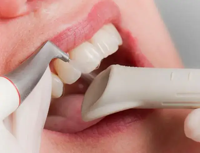 Czy można myć zęby po piaskowaniu? Wszystko, co musisz wiedzieć o higienie po zabiegu