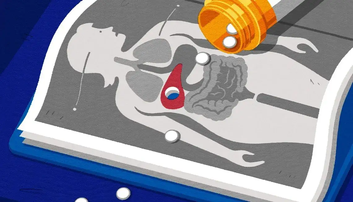 ¿Qué medicamentos dañan tu hígado? Guía para protegerte.