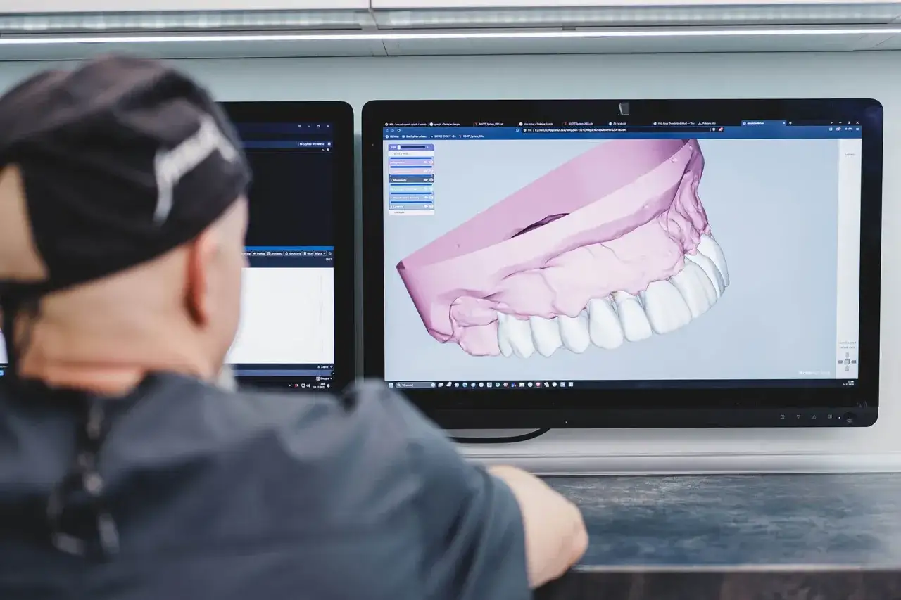 Implanty Szczecin gdzie najlepiej – wybierz klinikę z najwyższą jakością