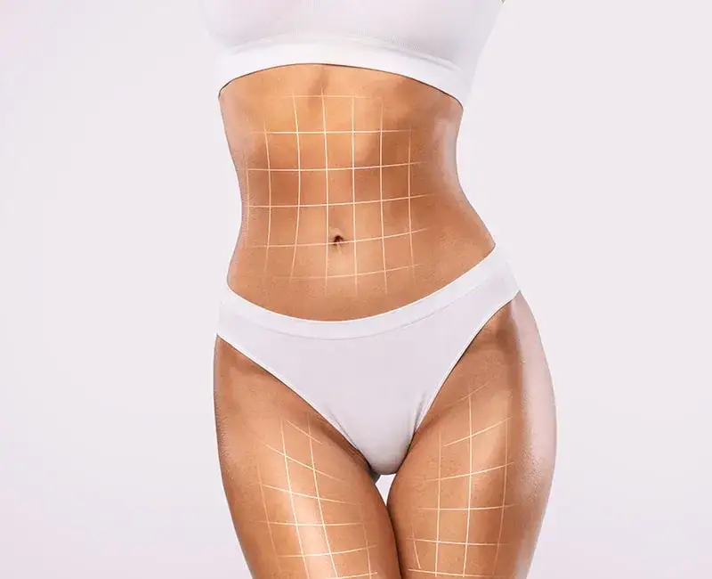 Liposukcja gdzie najlepiej: wybierz najlepsze kliniki w Polsce