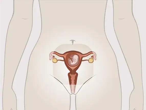 Jak wychodzi dziecko z macicy - krok po kroku do narodzin