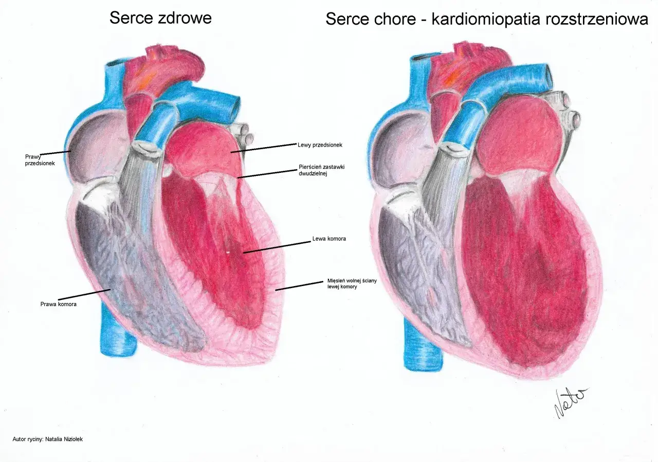 Kardiomiopatia rozstrzeniowa (DCM) u psów: Jak chronić serce?
