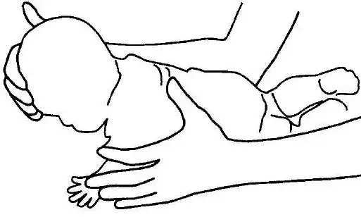 Co zrobić gdy dziecko trzyma główkę na jedną stronę - ważne kroki do podjęcia