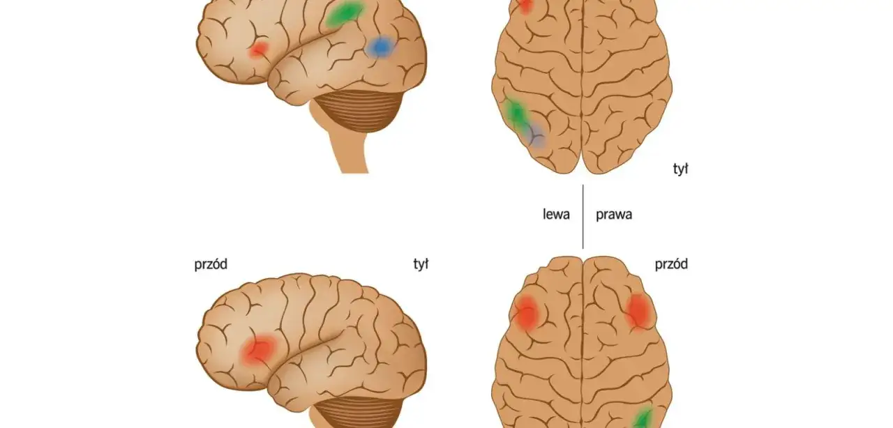 Zespół Aspergera a dysleksja: Czy mogą występować razem?
