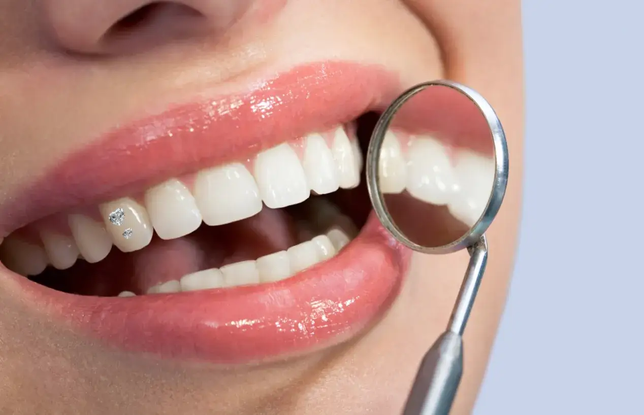 Biżuteria nazębna jak zrobić: krok po kroku bez ryzyka uszkodzenia zębów