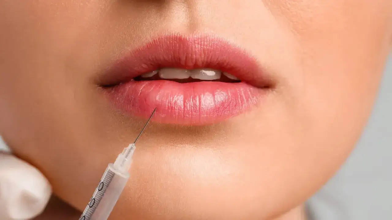 Kwas hialuronowy do ust: Jak wybrać, by uniknąć 'kaczego dzióbka'?