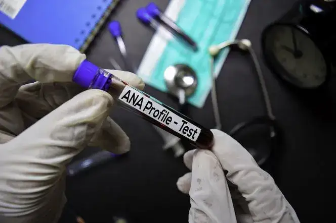 Badanie ANA co wykrywa i jak może zmienić Twoje zdrowie