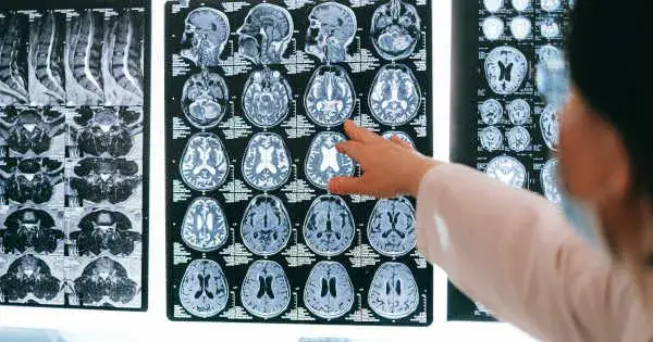 Jak gra w szachy wpłynie na mózg? Odkryj niesamowite korzyści dla rozwoju poznawczego, emocjonalnego i społecznego